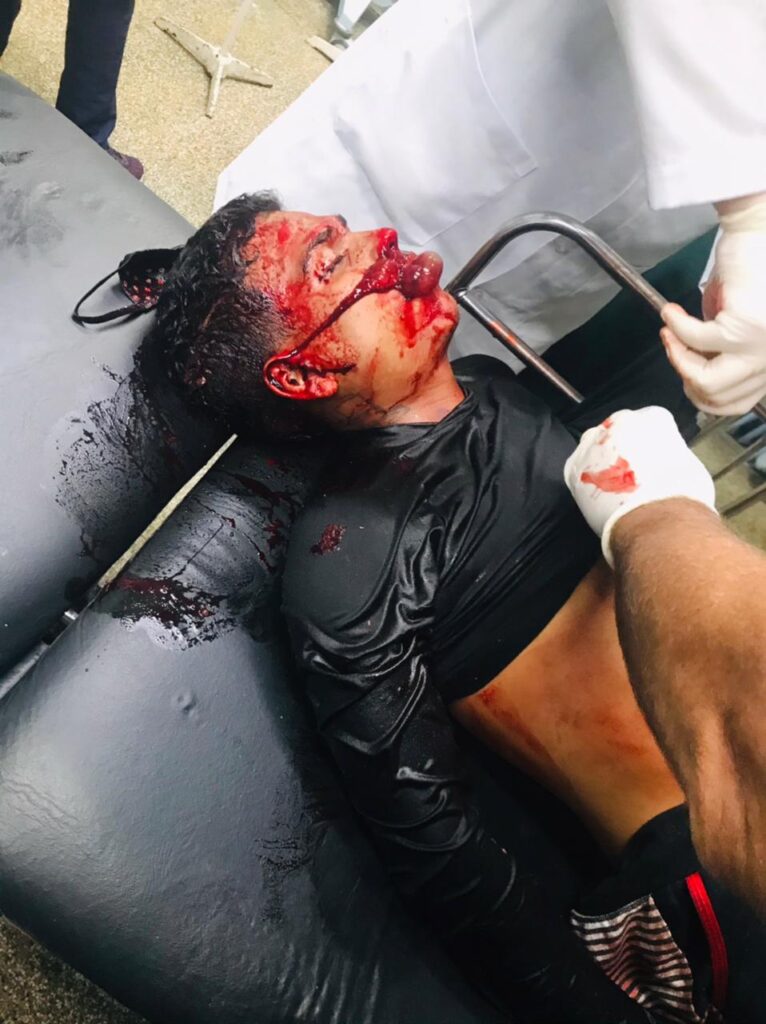 cdc32f1f-25aa-4394-82a1-4e8f4945aed4-766x1024 Troca de tiros entre PMs e criminosos, deixa três morto e um ferido em Manaus; imagens fortes