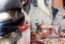 Vídeo: Mulher perde as duas perdes após ser brutalmente atropelada em calçada