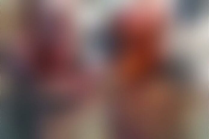 homem com rosto queimado