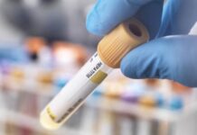 Live nesta quarta-feira alerta sobre formas de prevenção às hepatites virais