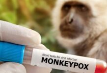 Amazonas confirma 5° caso de varíola dos macacos