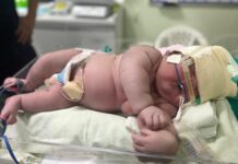 Bebê nasce com mais de 7 quilos em Parintins e pode ser o maior do Brasil