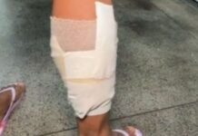 Trabalhadora é alvejada a tiros para entregar seu celular aos criminosos em Manaus