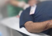 Motorista é ferido à faca nos braços e rosto durante assalto ao transporte coletivo em Manaus