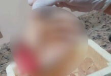 Homem tem a mão decepada no terçado por conta de rixa antiga em Barreirinha