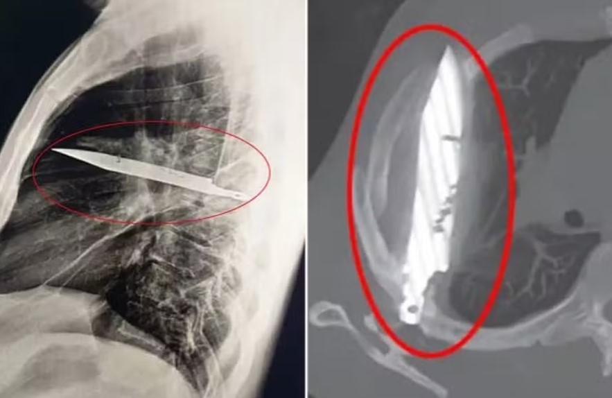 Captura de tela 2025-08-15 104042