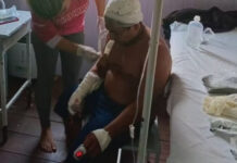 Ataque de onça deixa indígena ferido em Lábrea, no interior do Amazonas