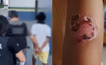 Homem é preso por t0rtur4r os filhos com utensilhos domésticos quentes em Manaus