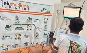 Pioneira em Telessaúde, Parintins ultrapassa 3,6 mil eletrocardiogramas em 2026 e prepara expansão dos pontos de atendimento